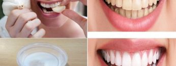 An amazing solution for cleaning your teeth