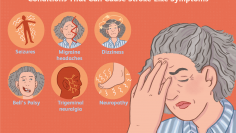 Symptoms of a stroke