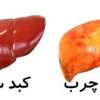 كبدچرب
